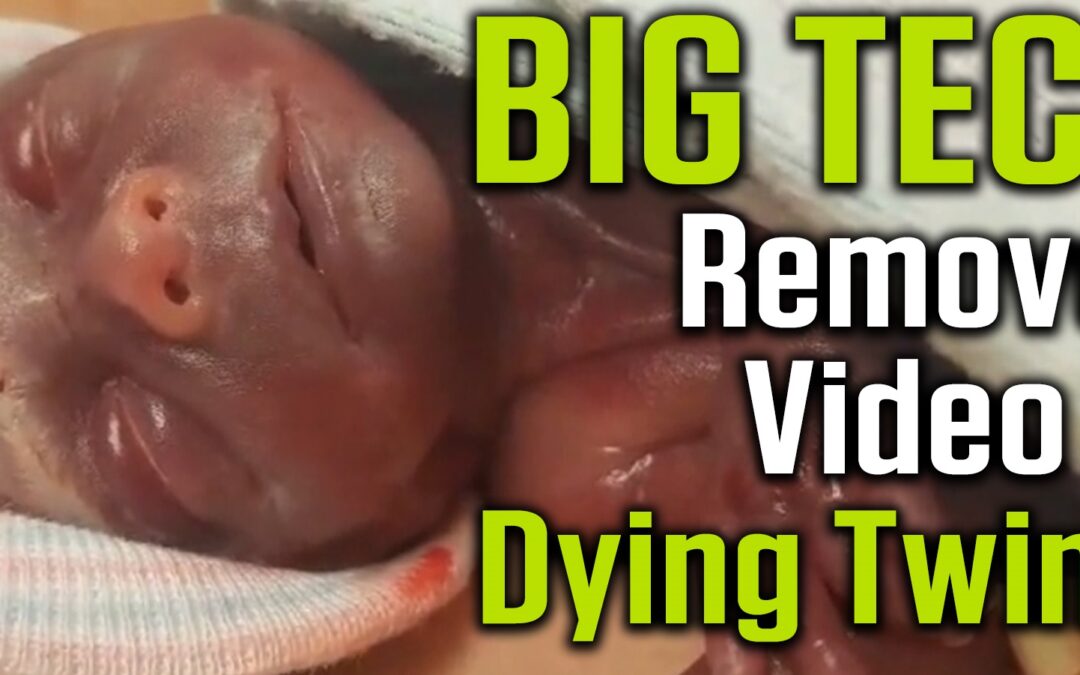 BIG TECH Censors Born Alive Victims